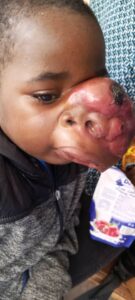 benoit-maxillofacial