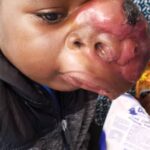 benoit-maxillofacial