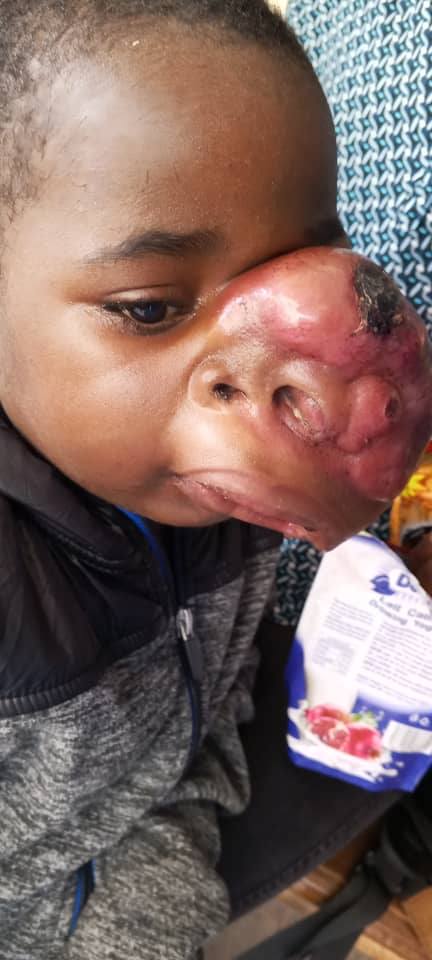 benoit-maxillofacial